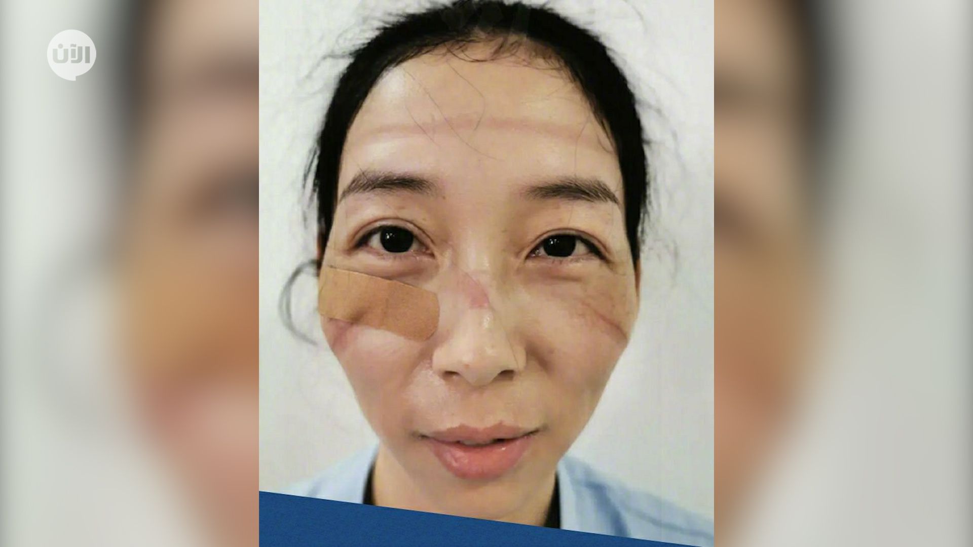 معاناة يومية للأطباء المعالجين لمرضى فيروس كورونا حول العالم