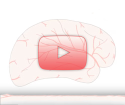 علم الأعصاب خلال دقيقتين: السكتة الدماغية