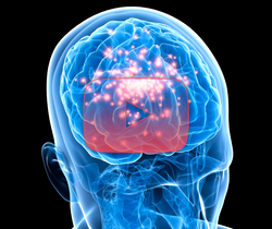 علوم الأعصاب خلال دقيقتين: الصرع