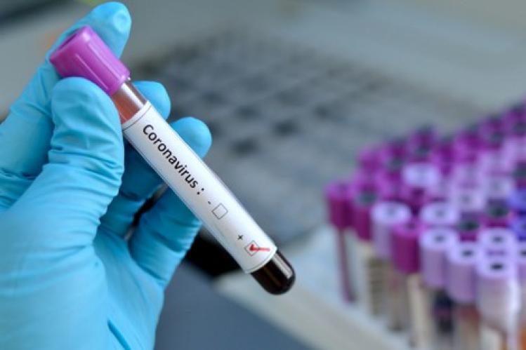 إصابة ترفع حصيلة “كوفيد-19” بمستشفى تطوان