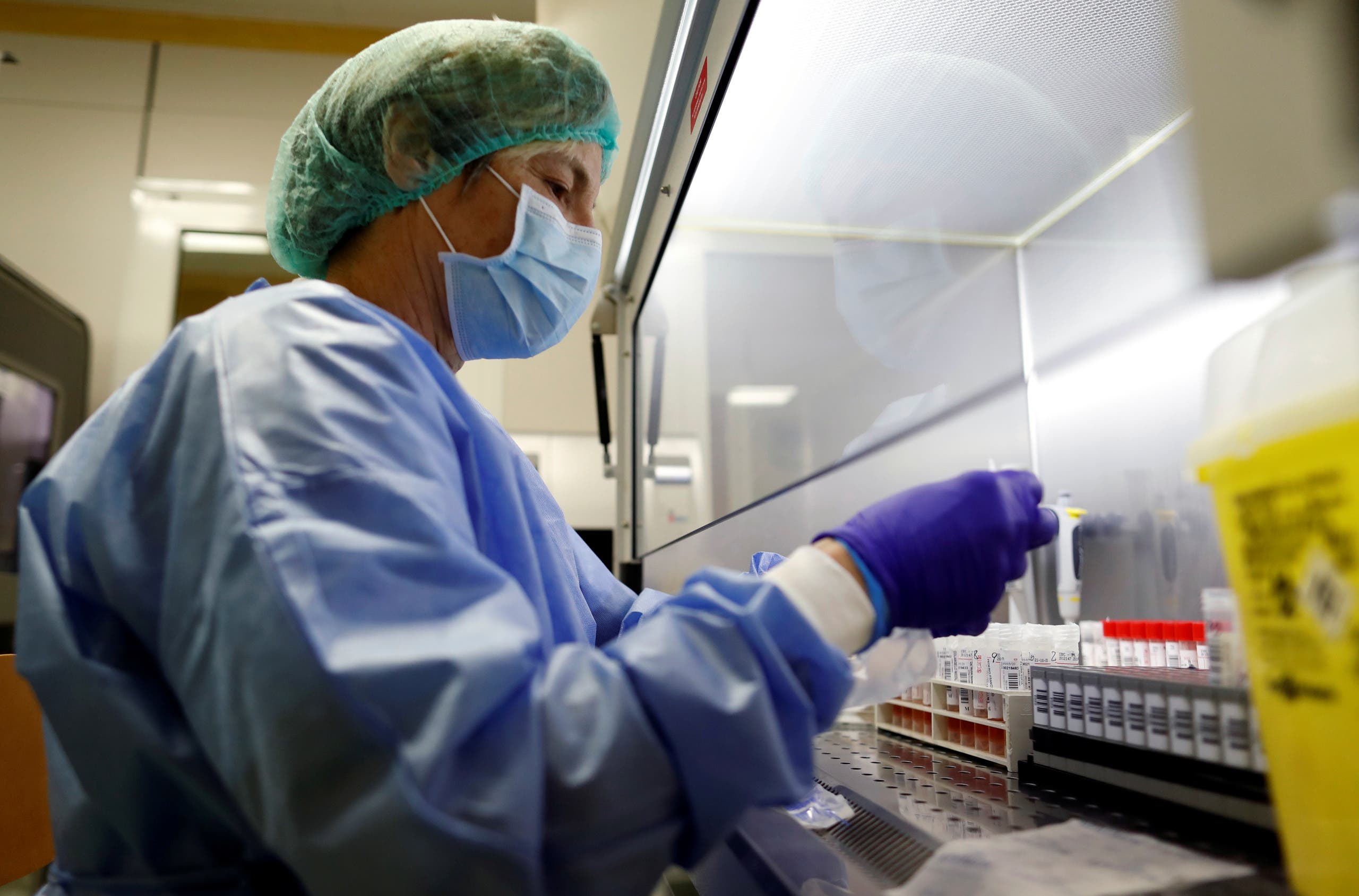 الصداع وفقدان حاسة الشم.. أبرز عوارض الوباء في أوروبا