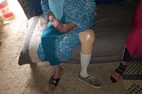 سيدة خمسينية تنشد المساعدة أمام الإعاقة والفاقة