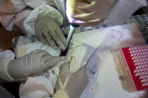 علماء “إمبريال كوليدج” تحدد موعد التجارب البشرية للقاح كورونا