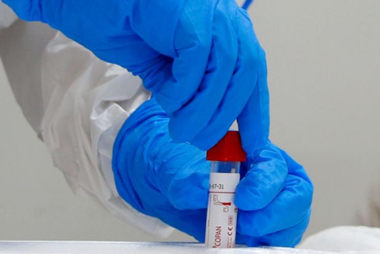 نسبة التعافي من “كوفيد-19” 71,77% بالمغرب