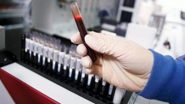 خبر سار من لندن..  اختبار لكورونا بأقل من 20 دقيقة