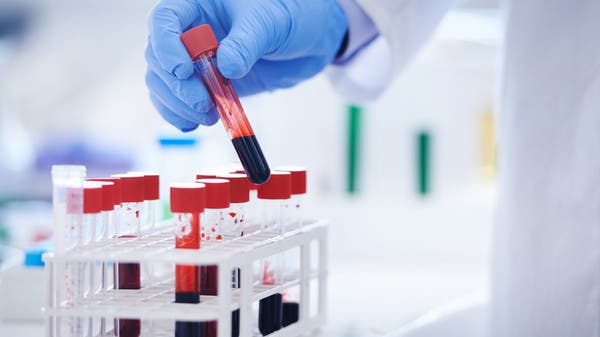 كورونا يرأف بهم.. أصحاب فئة الدم هذه محظوظون!