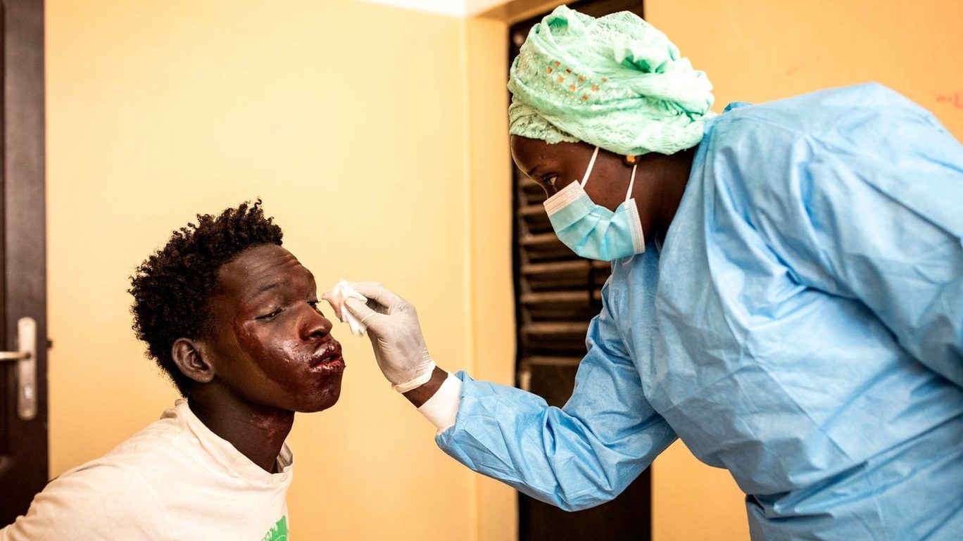 قادم من البحر .. مرض “غريب” يظهر في السنغال (صور)