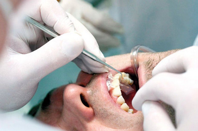 السكري يهاجم الأسنان أيضا!