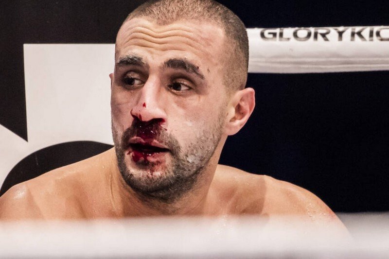 هكذا سقط البطل العالمي بدر هاري بالضربة القاضية في أمسية “الغلوري”