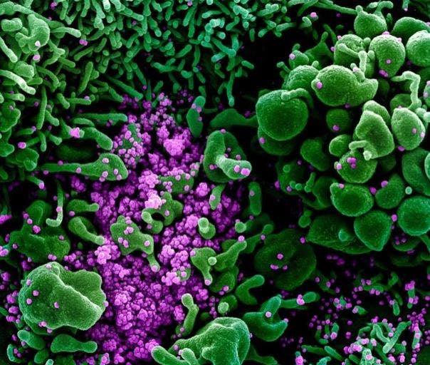 مخاوف “المتحور” تأكدت.. الأكثر فتكاً على الإطلاق!