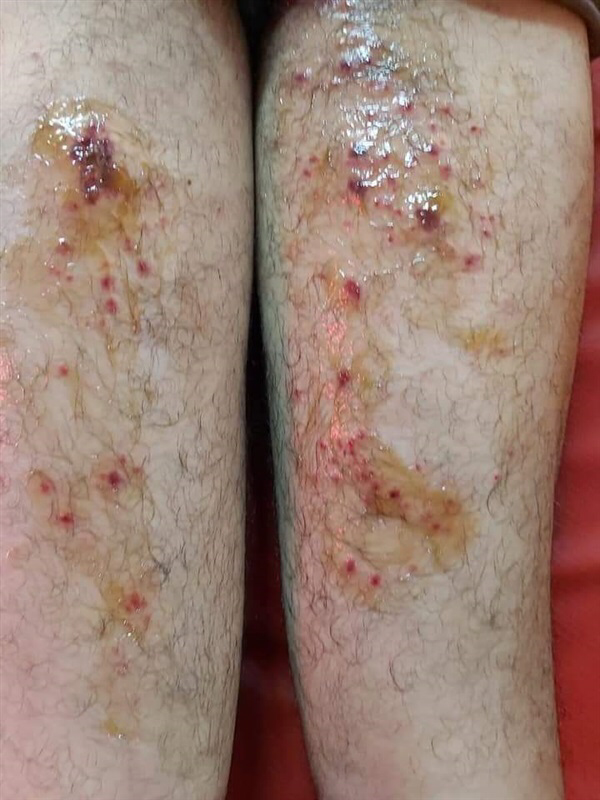 إصابات خطيرة لفنان مصري شاب بسبب محمد رمضان .. والدته تتوعد