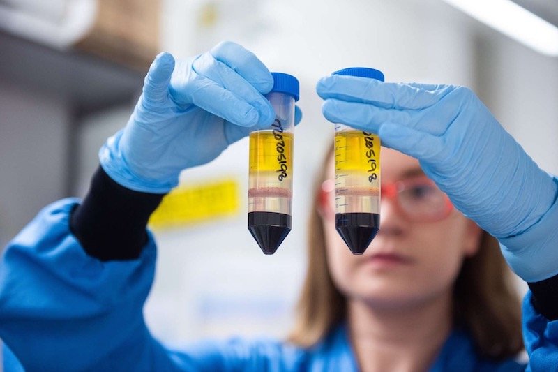 الحاجة إلى المواد الأولية تسبق رفع براءات اختراع لقاحات “كورونا”