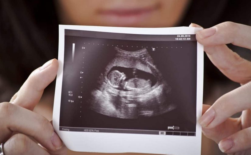 هل الجنين في بطن أمه عليه زكاة ؟