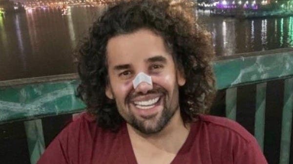 هل خضع حسين الجسمي لعملية تجميل؟.. الفنان يرد بصورة