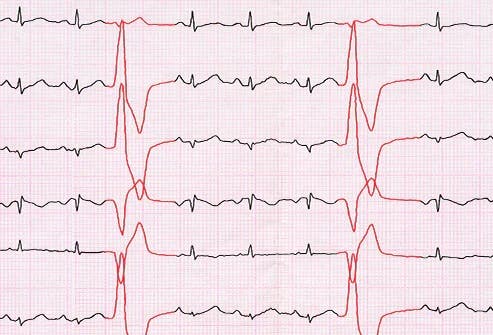 14 علامة غير متوقعة على احتمال الإصابة بسرطان الرئة