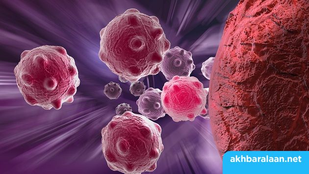 علاج ثوري جديد .. كبسولات تقضي على الأورام الليفية