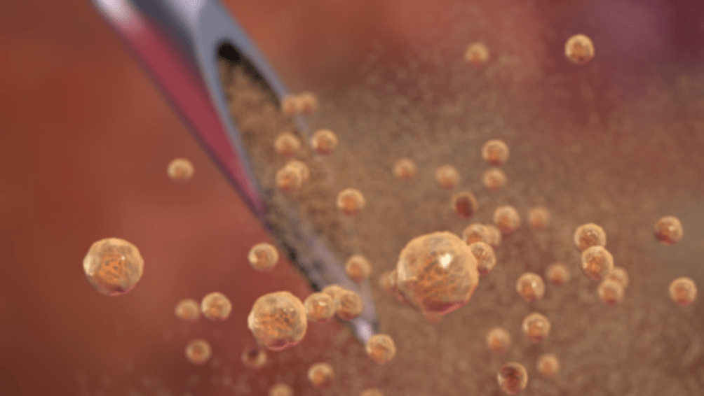 فيديو رائع لحظة بلحظة..  هكذا يخترق كورونا أجسادنا ويتغلغل