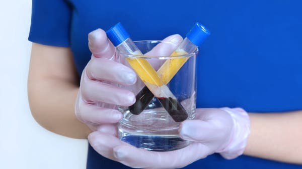 الصحة العالمية تجدد تحذيرها: لا لعلاج كورونا ببلازما الدم