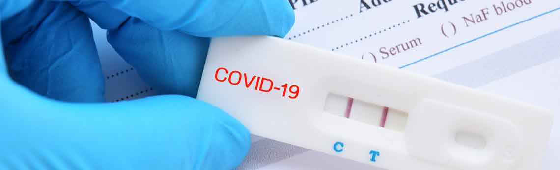 “الفحص السريع” ساهم أيضا بتسريع انتشار كورونا.. دراسة توضح