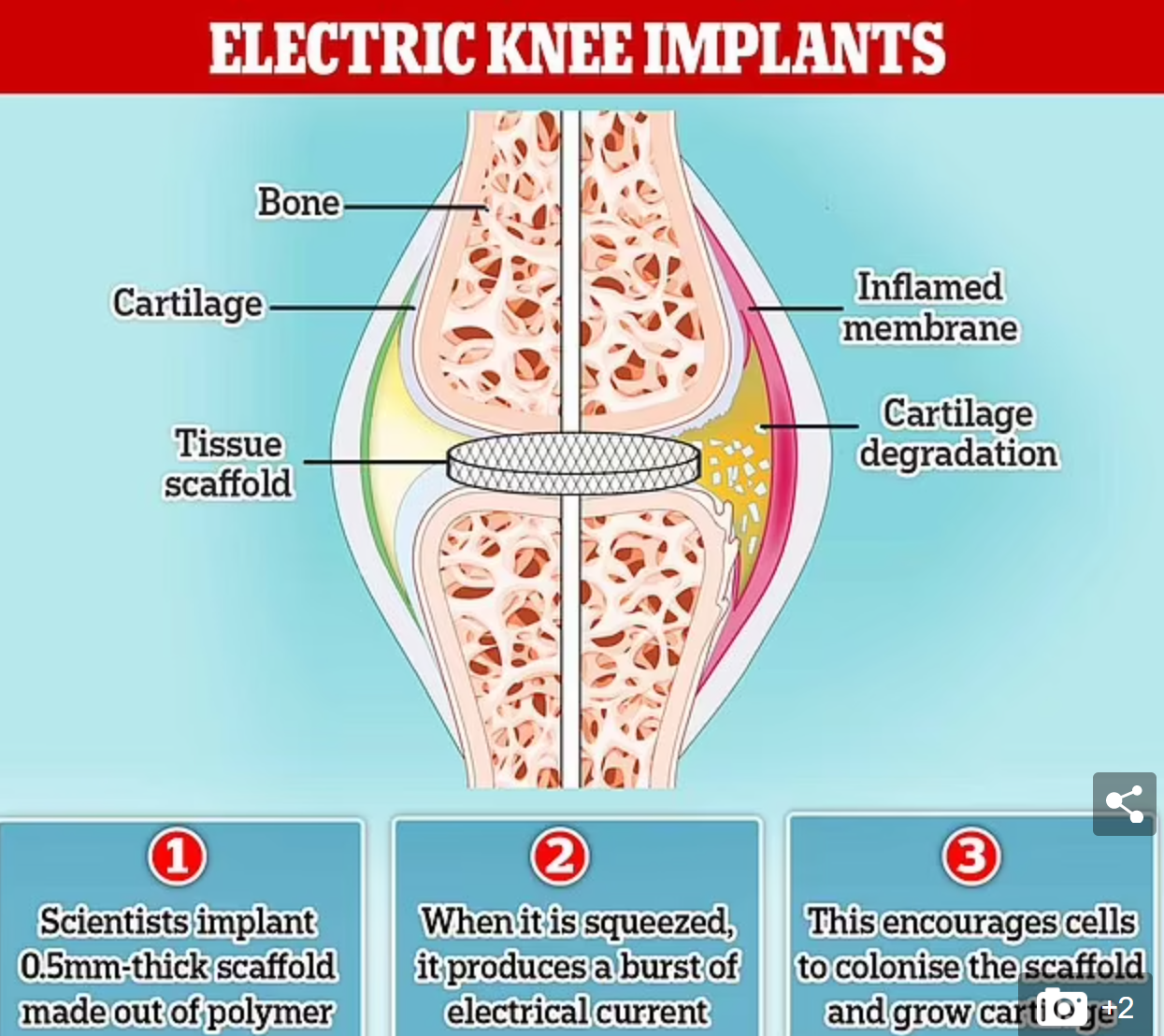 بشرى لمصابي التهاب المفاصل.. طريقة لإعادة نمو الغضروف
