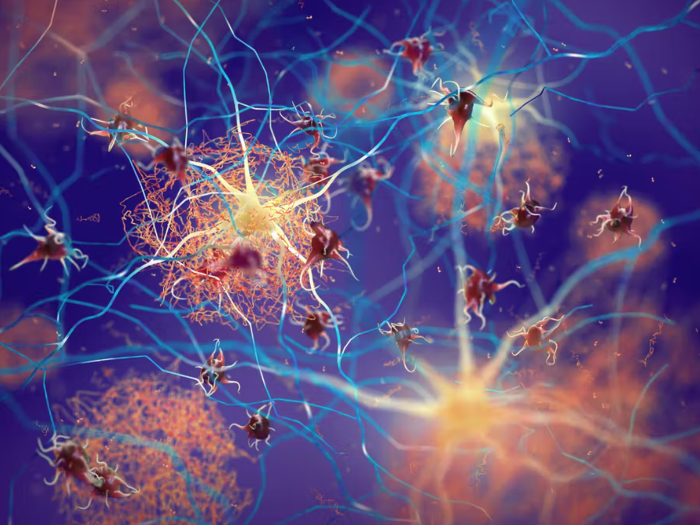 أدلة على العلاقة بين مرض الزهايمر والسهر ليلا