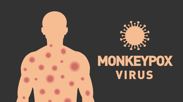 6 نصائح بسيطة.. هكذا تحمي نفسك من جدري القردة