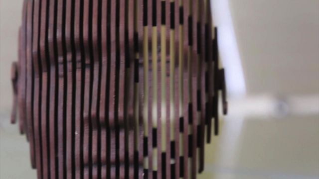 الزهايمر: لماذا يصيب النساء أكثر من الرجال؟