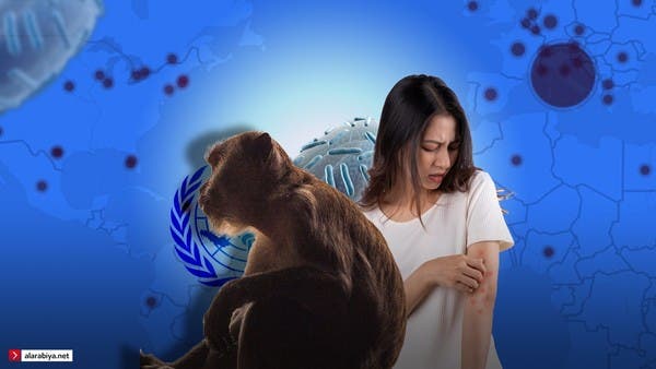 الصحة العالمية تطمئن: لا خوف من تحوّل جدري القردة لجائحة  