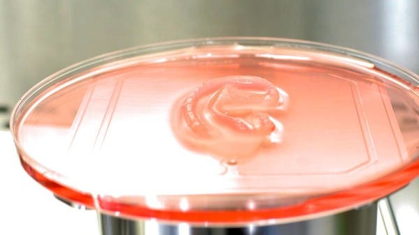 عملية زرع مبتكرة لعلاج صغر الأذن.. خلايا بشرية وطابعة ثلاثية الأبعاد